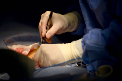 Surgery